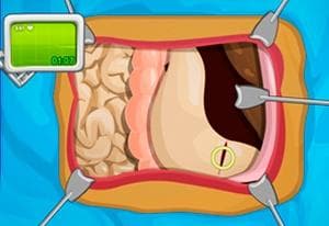 Operate Now: Stomach Surgery oyun kapağı