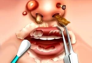 Nose Hospital oyun kapağı